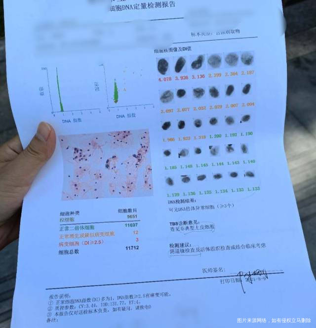 孕前检查做了个细胞DNA检查结果DNA倍体异