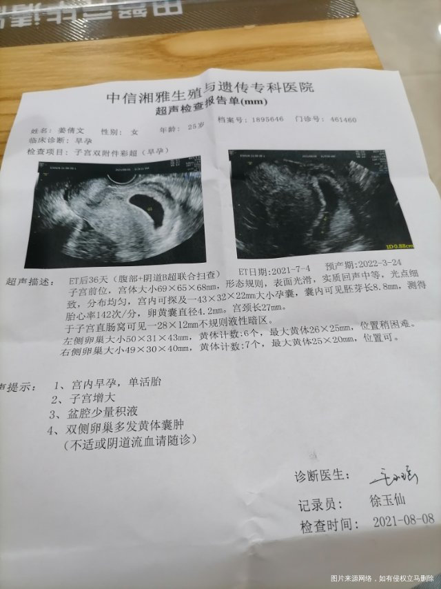 您好医生感谢您百忙之中抽空回复我的问题我今天