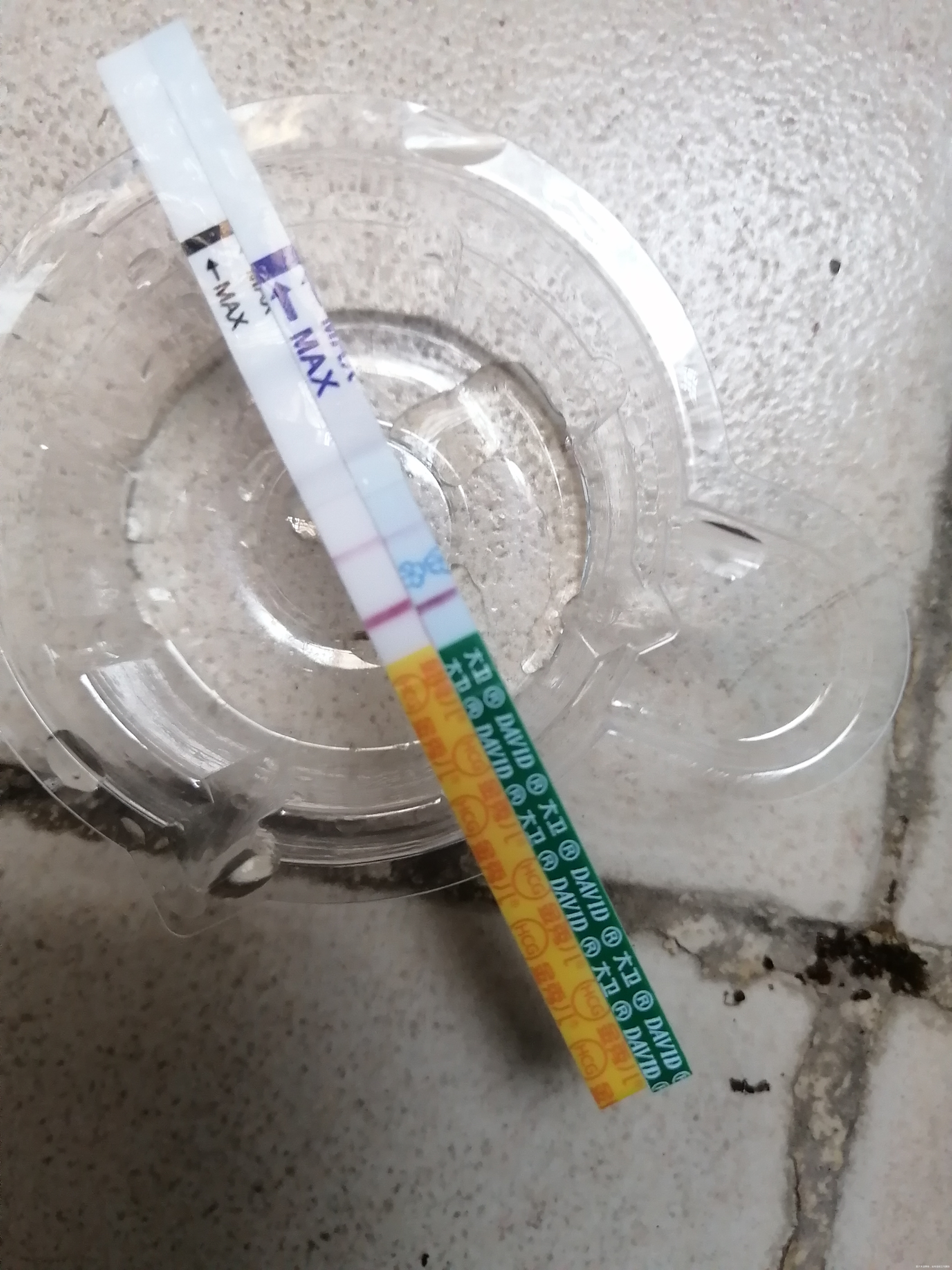 月经推迟4天小腹经常性疼痛