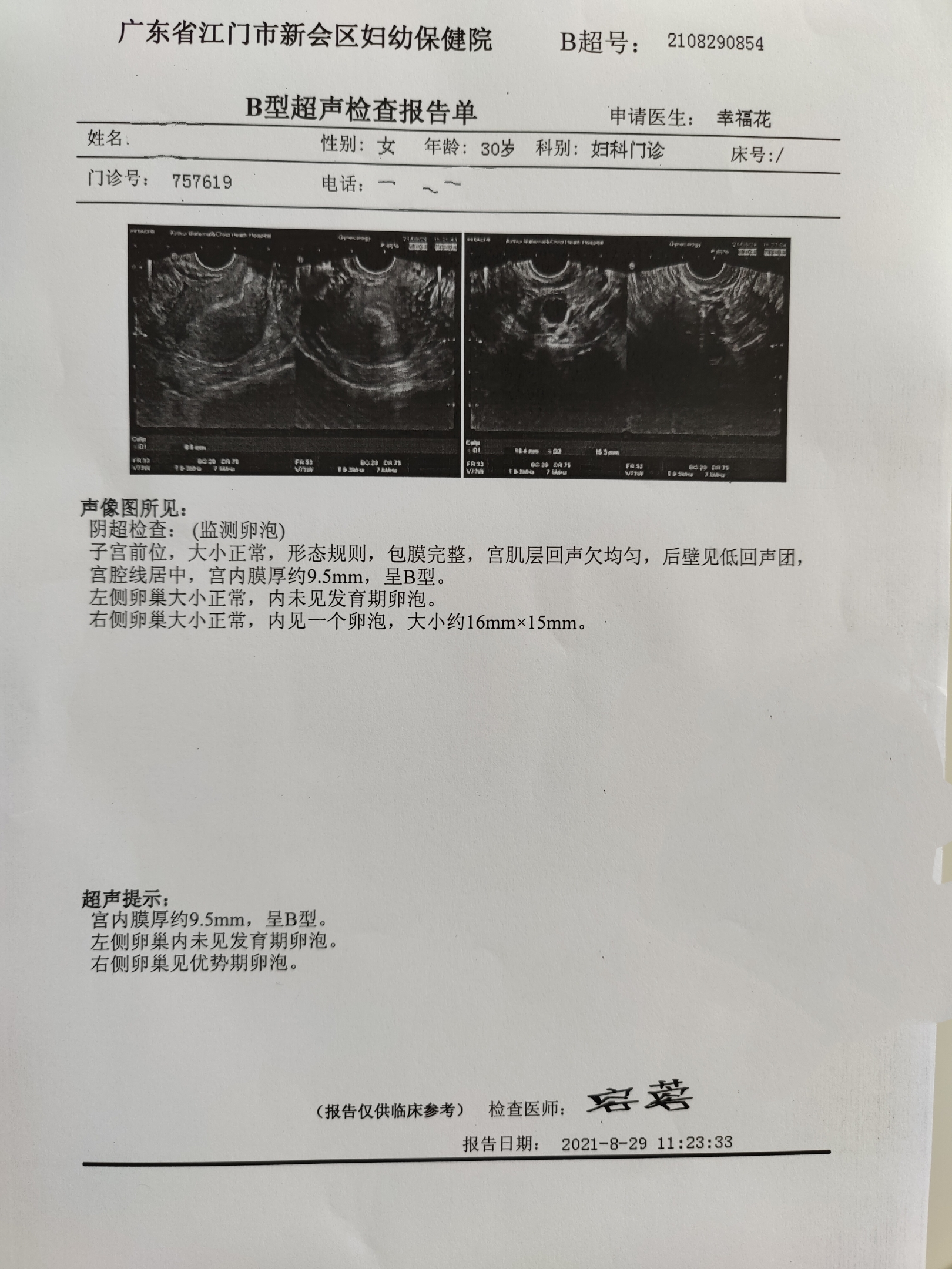 老婆月经周期25天2021818824日月经