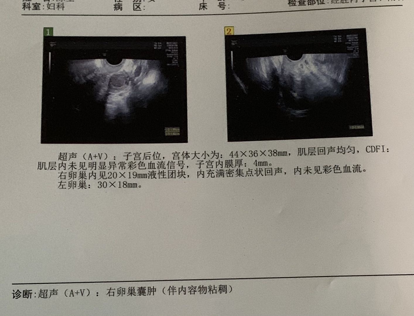 7月23来月经7月27干净8月6日又来了7月