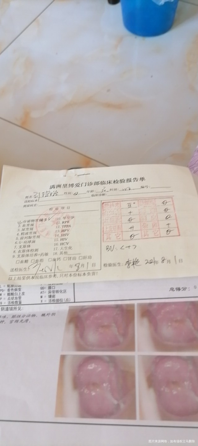 小腹疼痛下体瘙痒有异味白带多外阴道红肿热痛