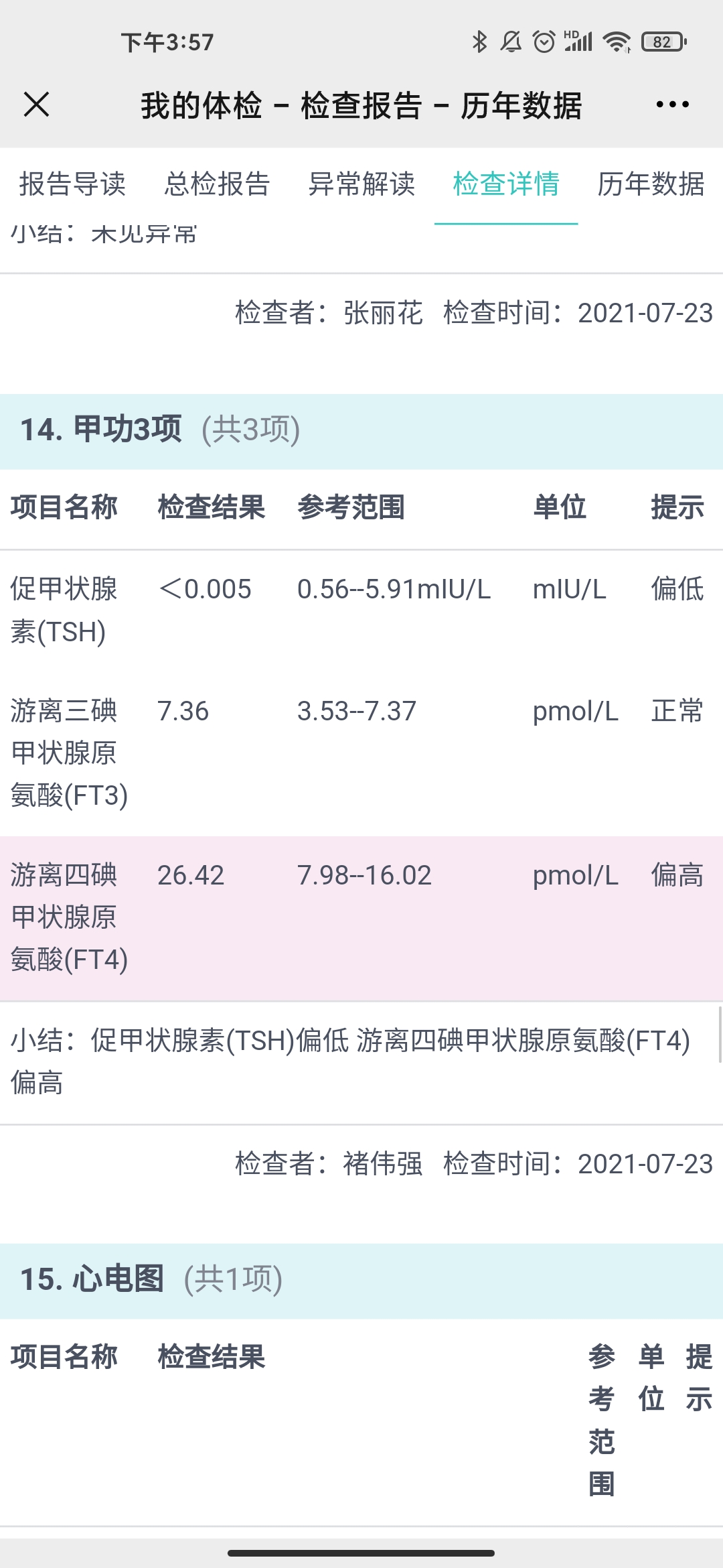 医生你好我在之前做检查时测甲功五项促甲状腺激