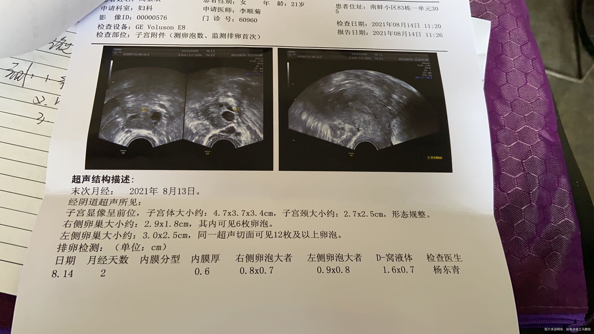 8月13号月经月经第二天开始吃了五颗来曲唑月