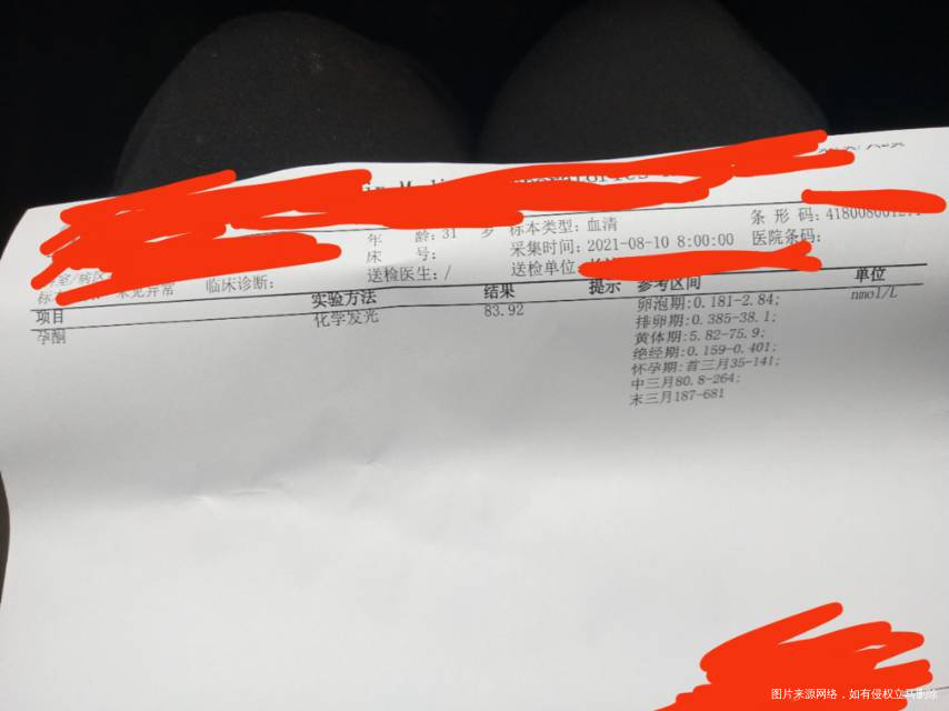 可以帮我看一下这个结果吗宫外孕双胎葡萄胎按数