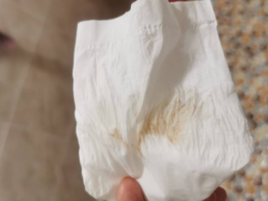 多囊胰岛素抵抗吃着二甲双胍之前卵泡不容易长大