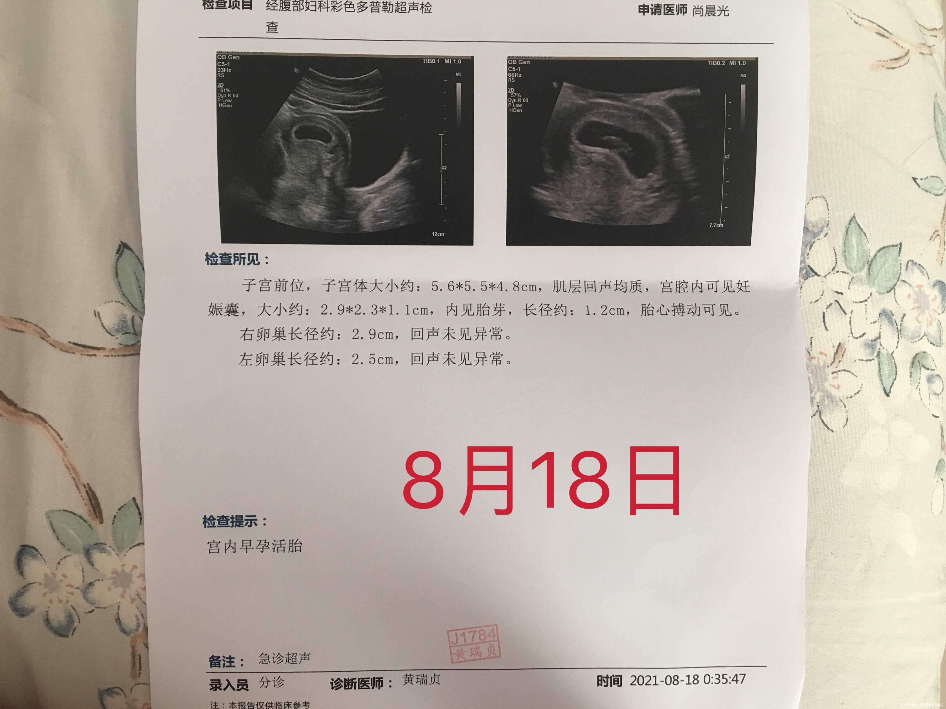 您好我现在孕7加4我的b超正常吗孕囊大小和胎