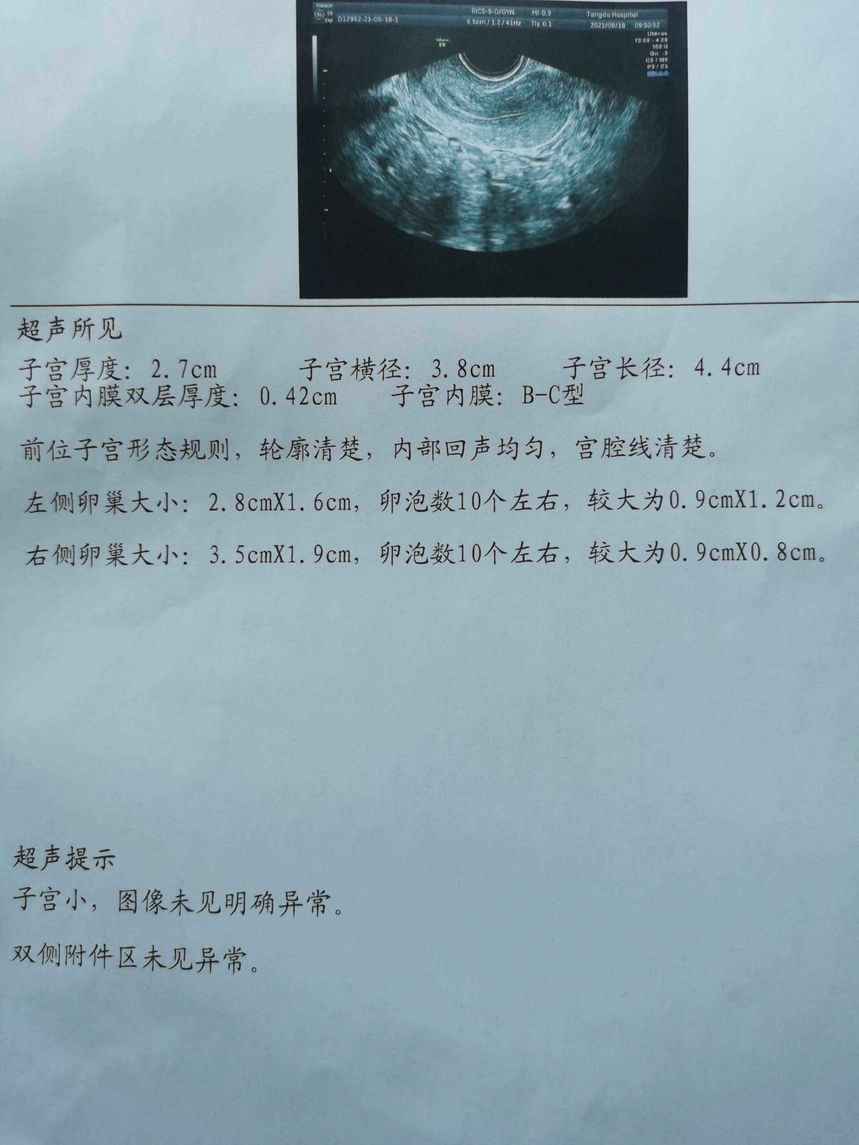 能帮我看看我这个月左侧还是右侧排卵大概什么时