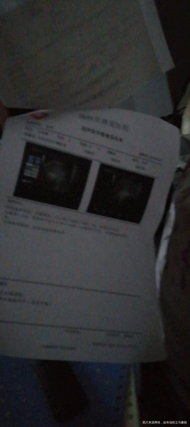 小腹疼痛下体瘙痒有异味白带多下体阴道红肿热痛