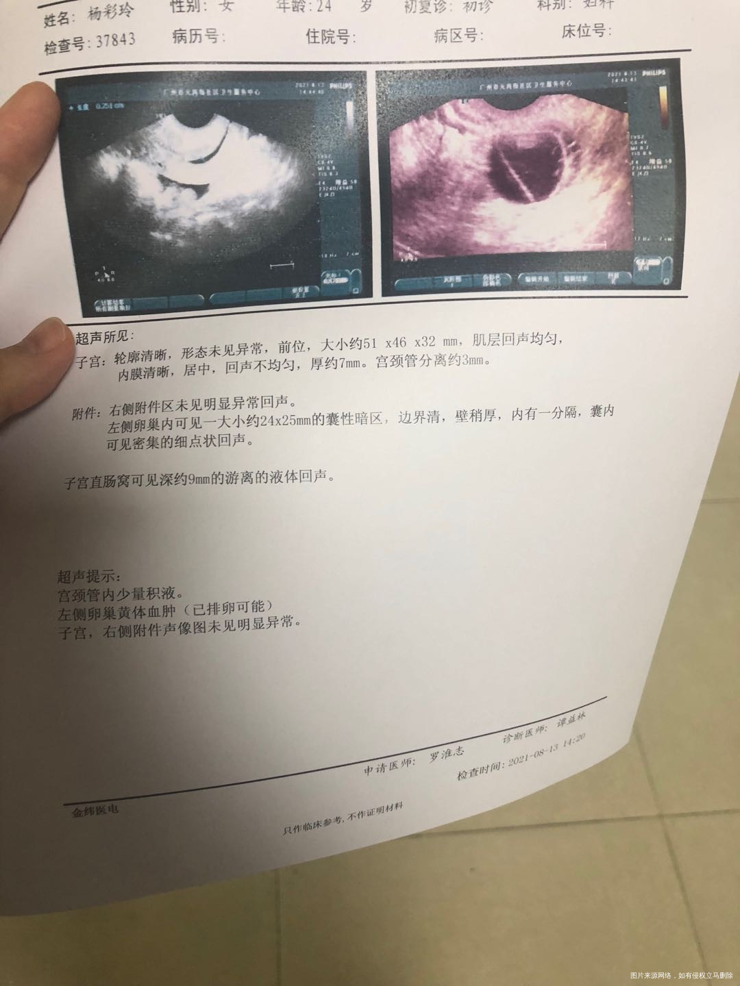 623刮宫胚胎染色体异常其他检查都正常729