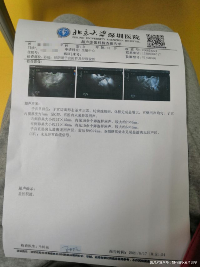 请问有盆腔积液可以促排吗