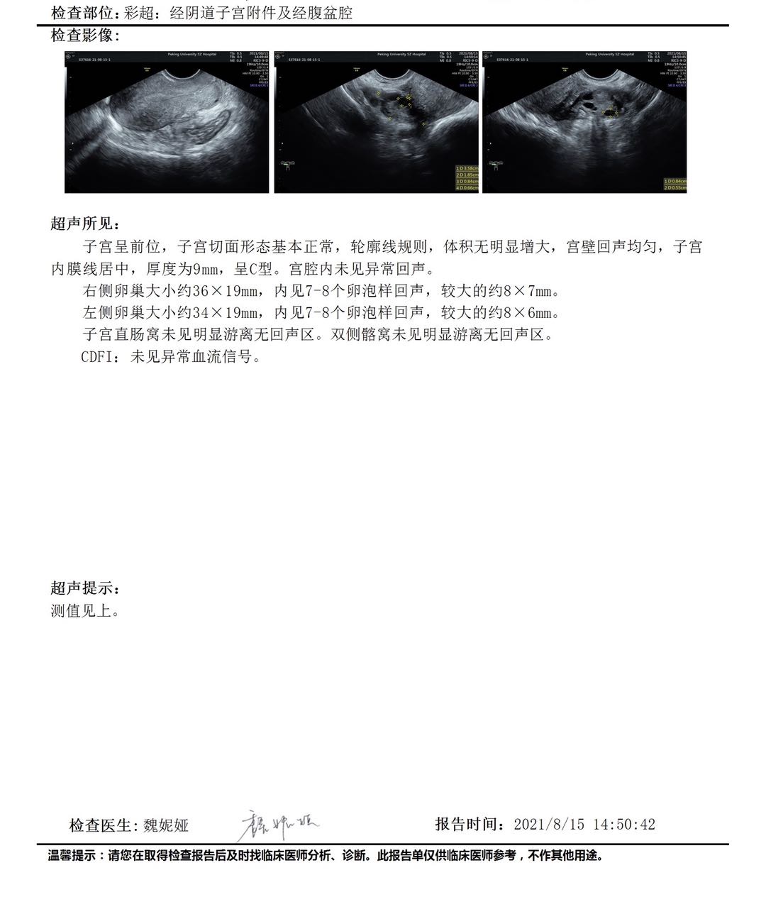 医生好帮忙看看月经第二天激素分泌和彩超检查结