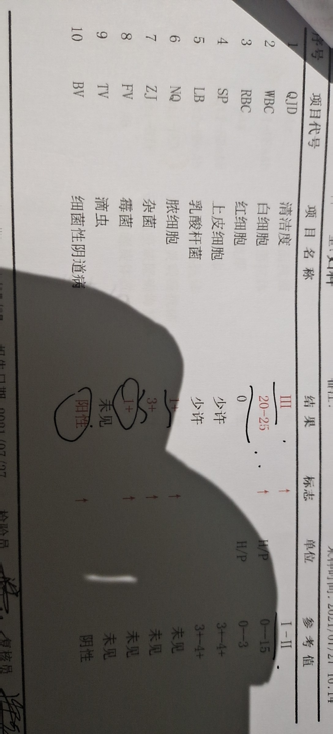 上次月经6月14例假推迟去检查的性激素还抽血