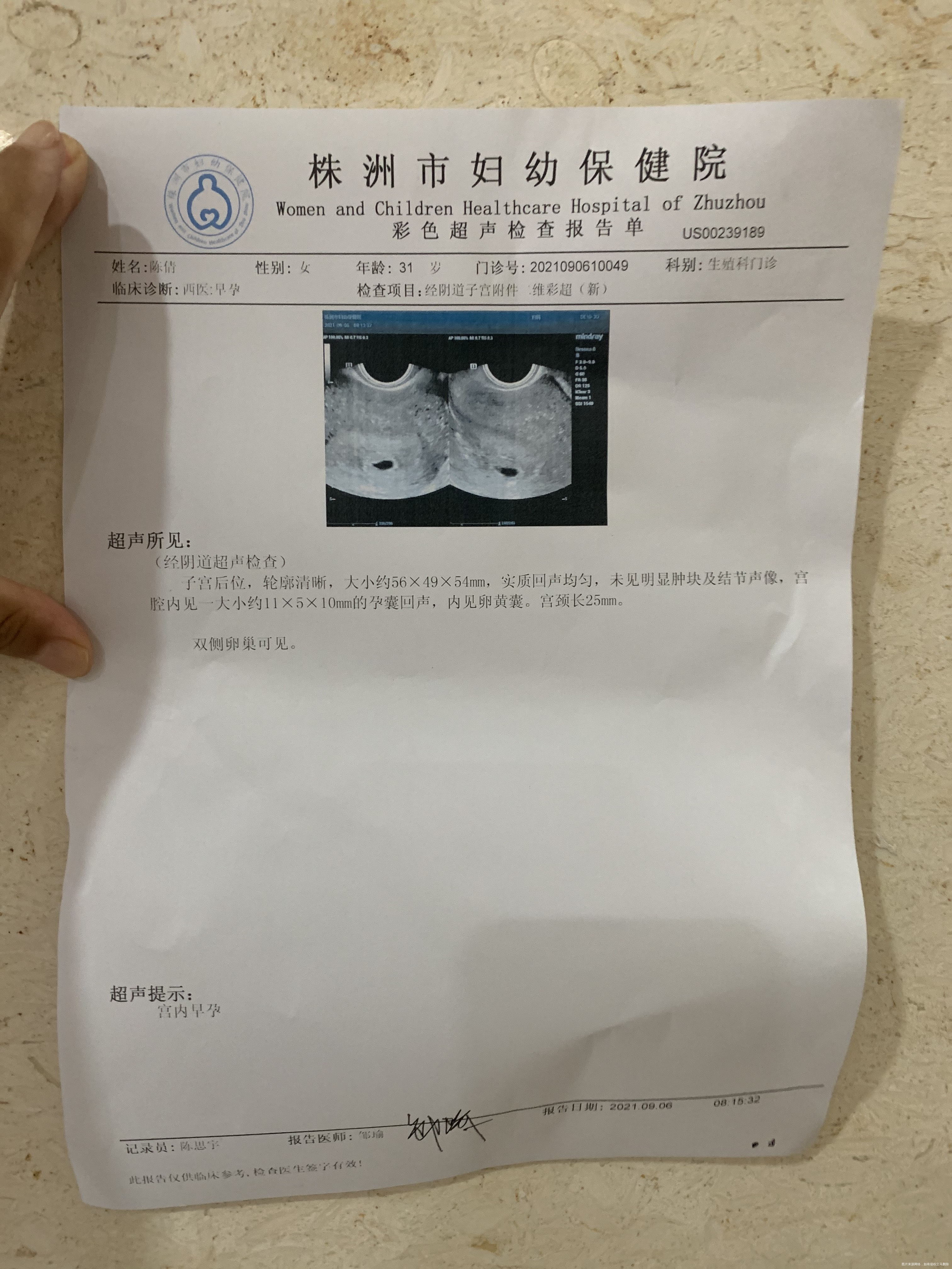 你好末次月经720但是824测出怀孕825血