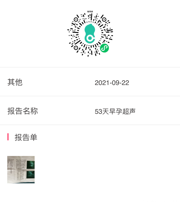 53天超声提示没有看到胎心问题大么同天HCG