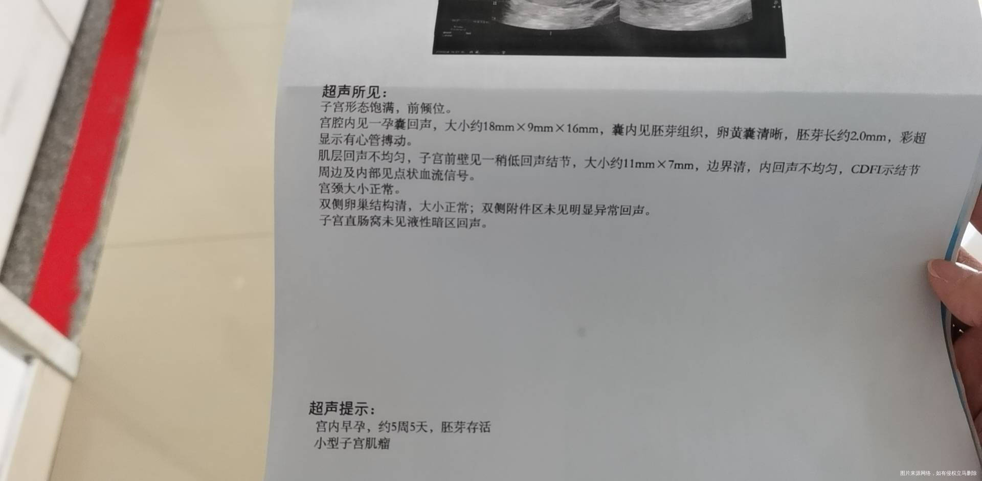 这个血值和胚胎还好吗小型子宫肌瘤是什么严重吗