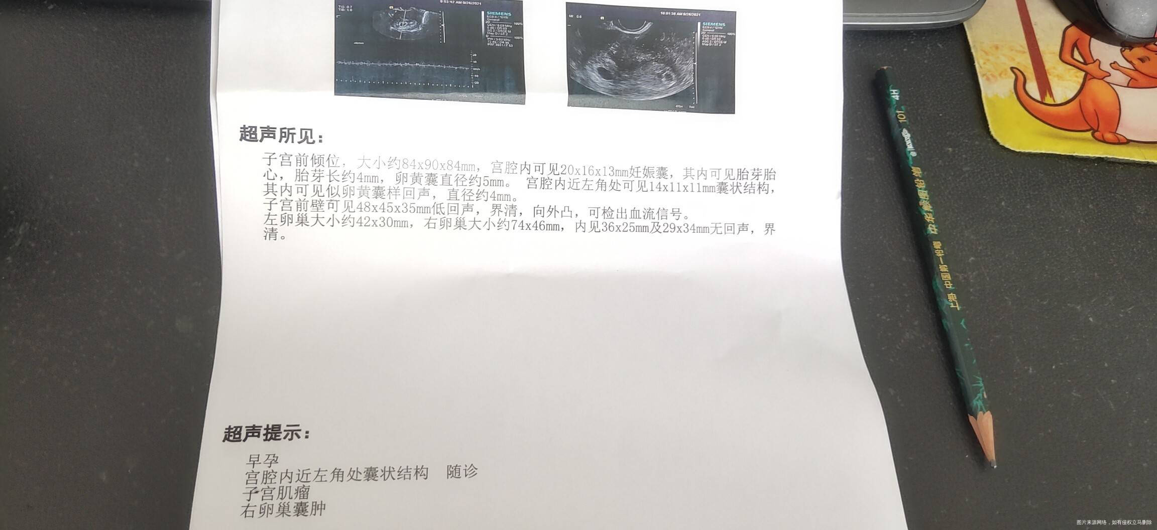 检查宫内孕一个宫腔内近近左角处囊装结构这种情