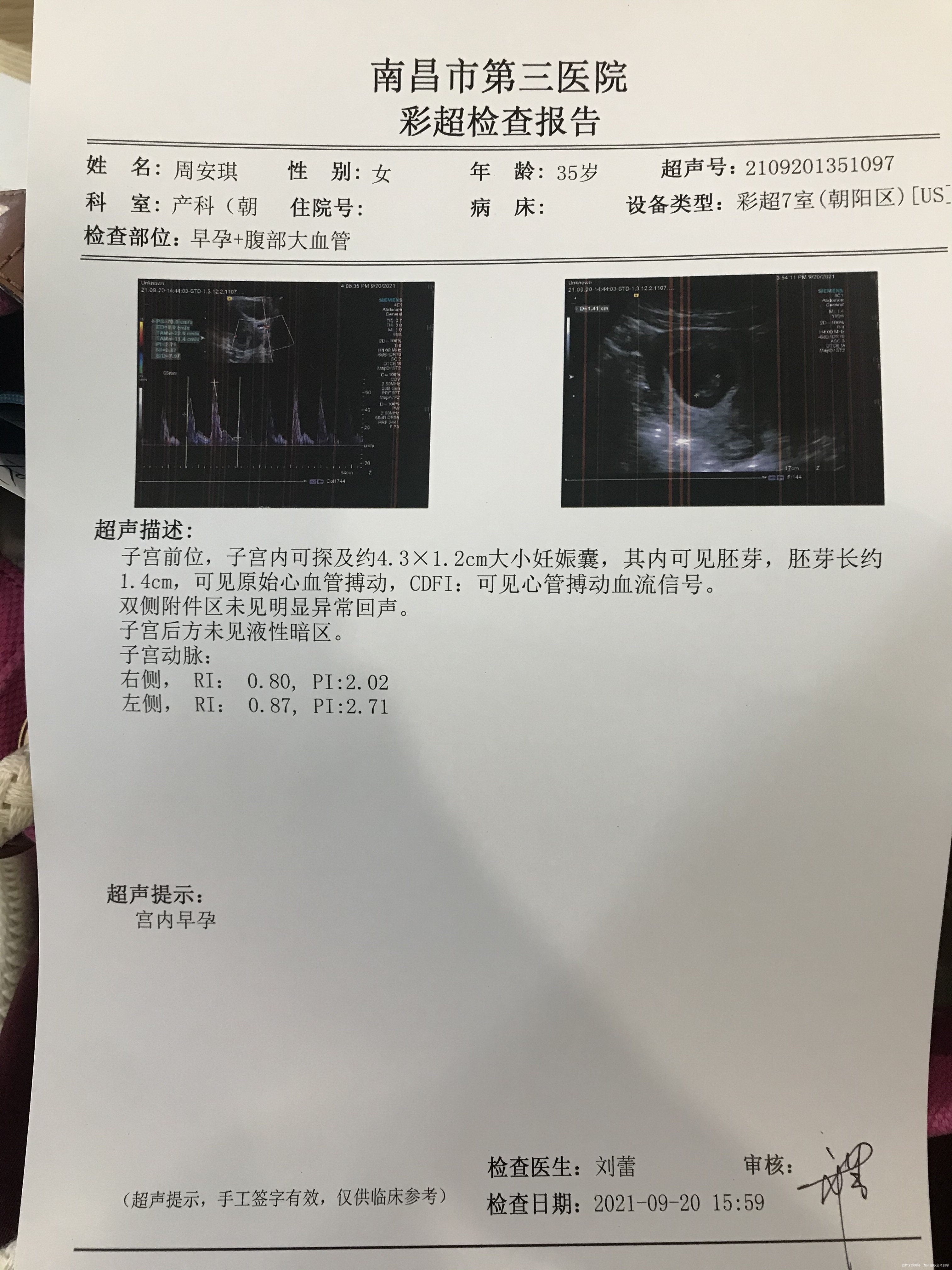 医生您好我现在孕55天请问这几个数值正常吗