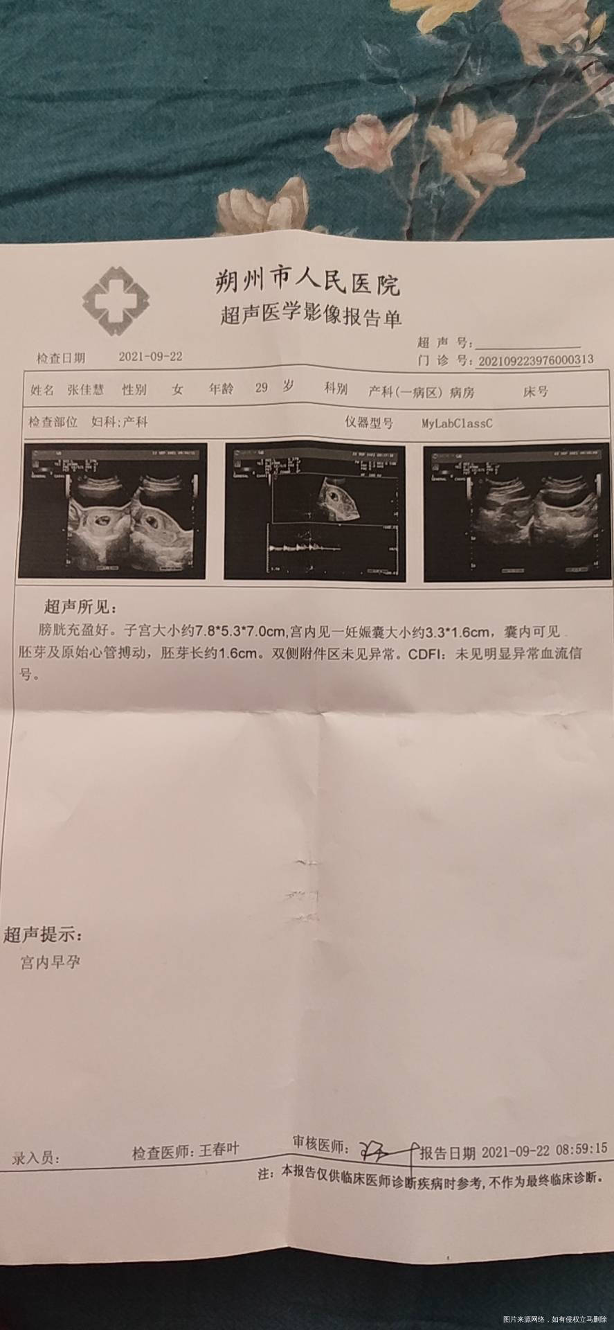 大夫看下正常吗怀孕多少周谢谢
