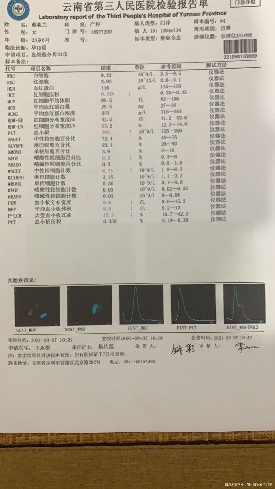 尿液有什么问题吗二张有什么意思