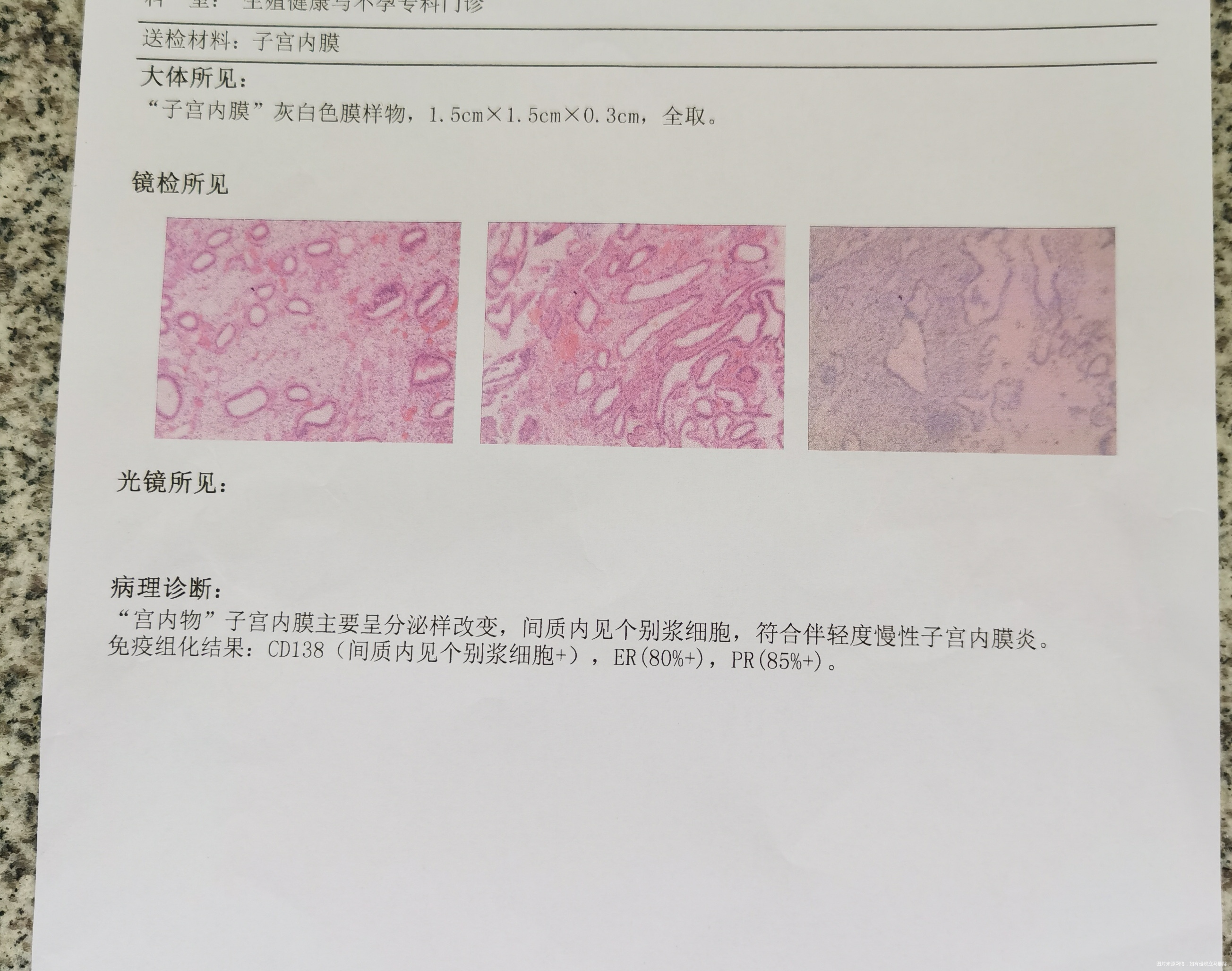 请问我的检验报告是怎么了呀