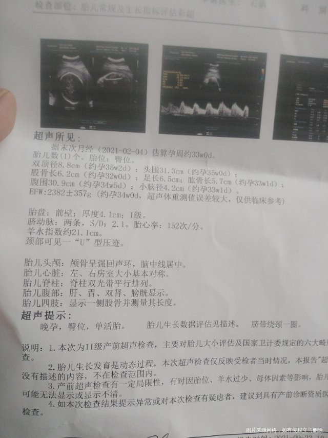 孕33周宝宝还是臀位能转过来嘛想顺产