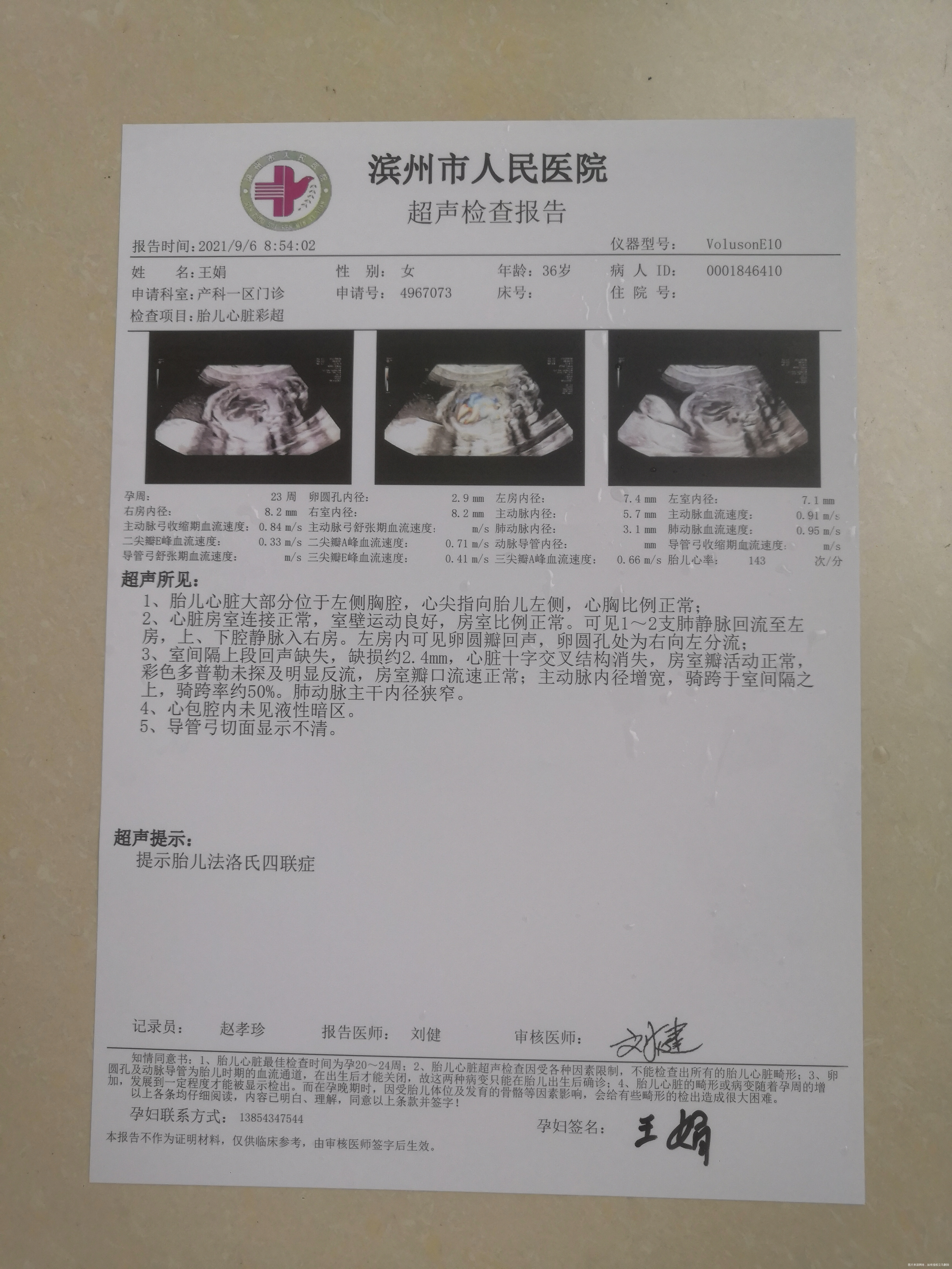 这个孩子是两针新冠疫苗之间怀孕的心脏彩超显示