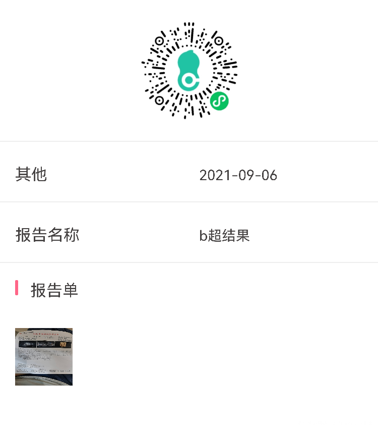 末次月经7月25日平常姨妈都会推迟个四五天的