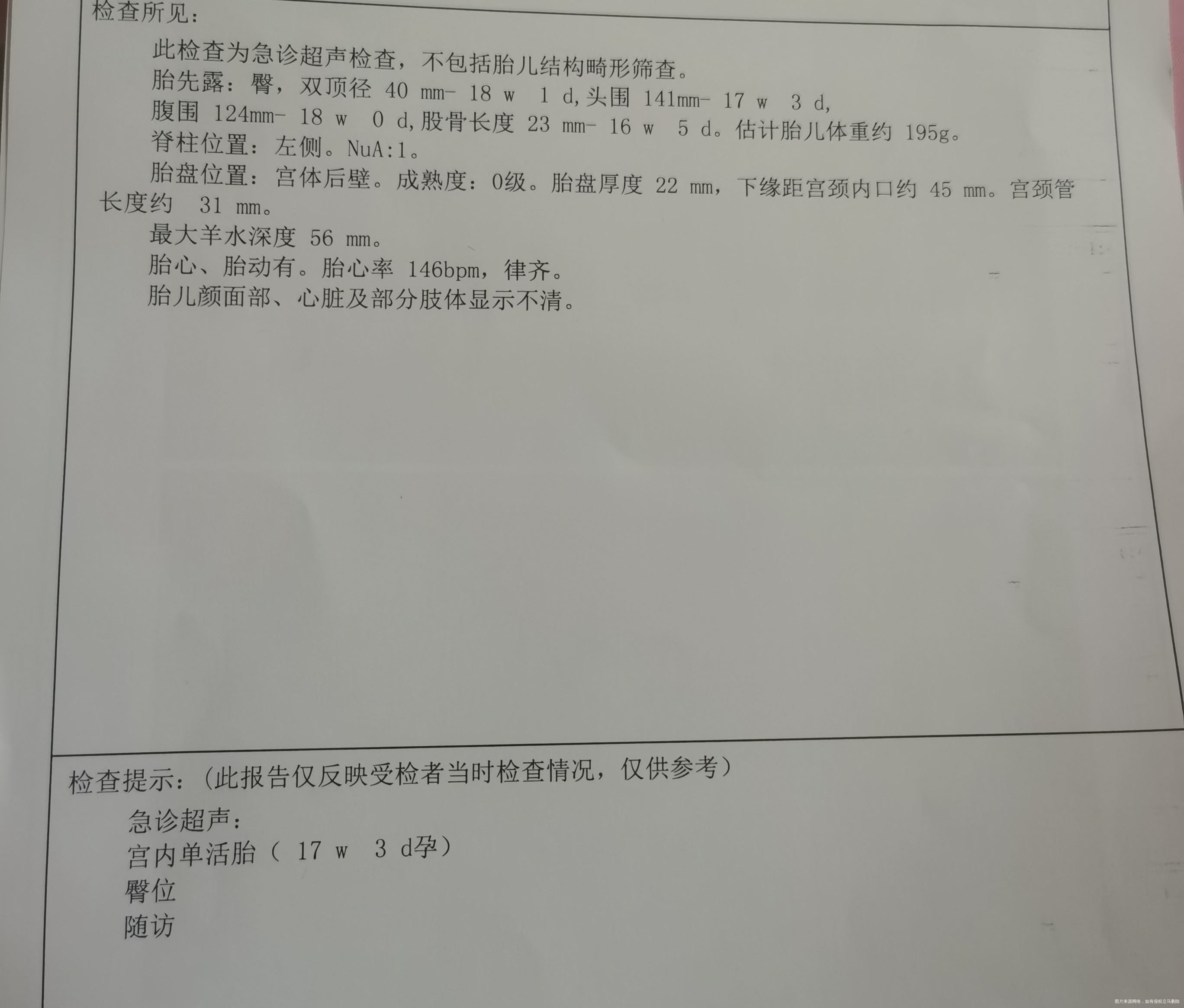 请医生帮我看一下1我有没有羊水过多2我的胎盘