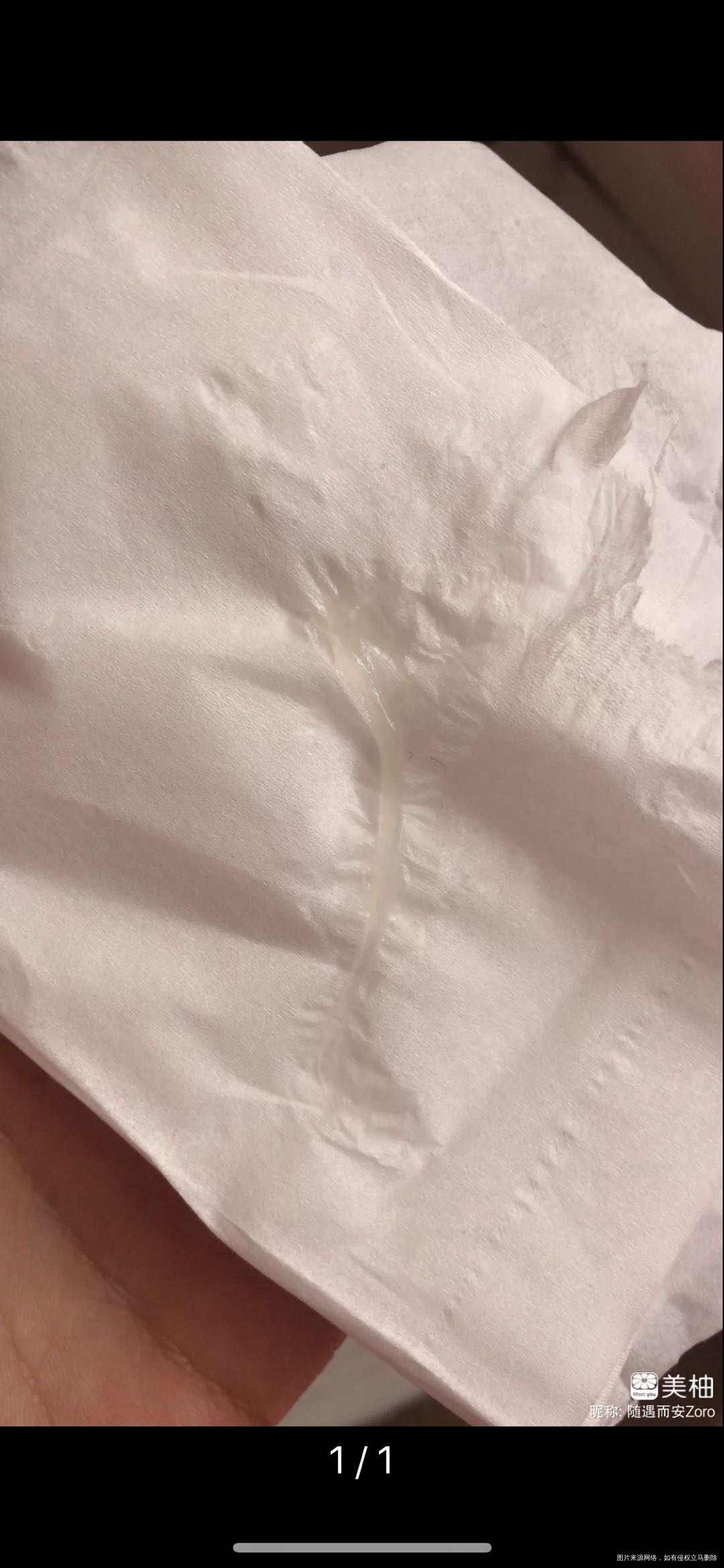 目前孕24周今天晚上上厕所发现白带跟果冻一样