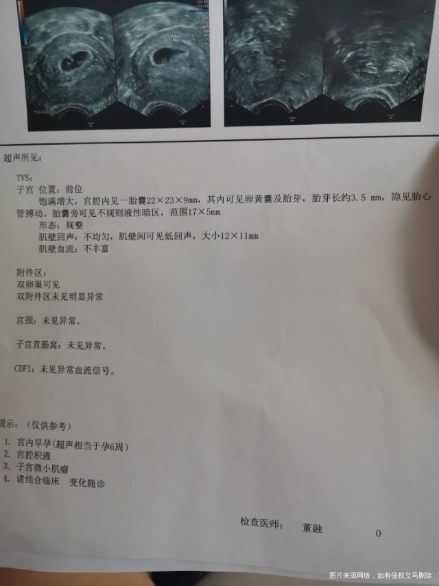 有宫腔积液隐见胎心搏动是否正常是否需要服用保
