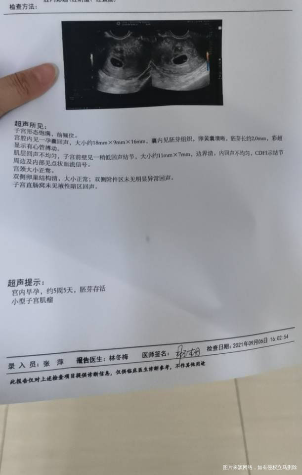 这个血值和胚胎还好吗小型子宫肌瘤是什么严重吗