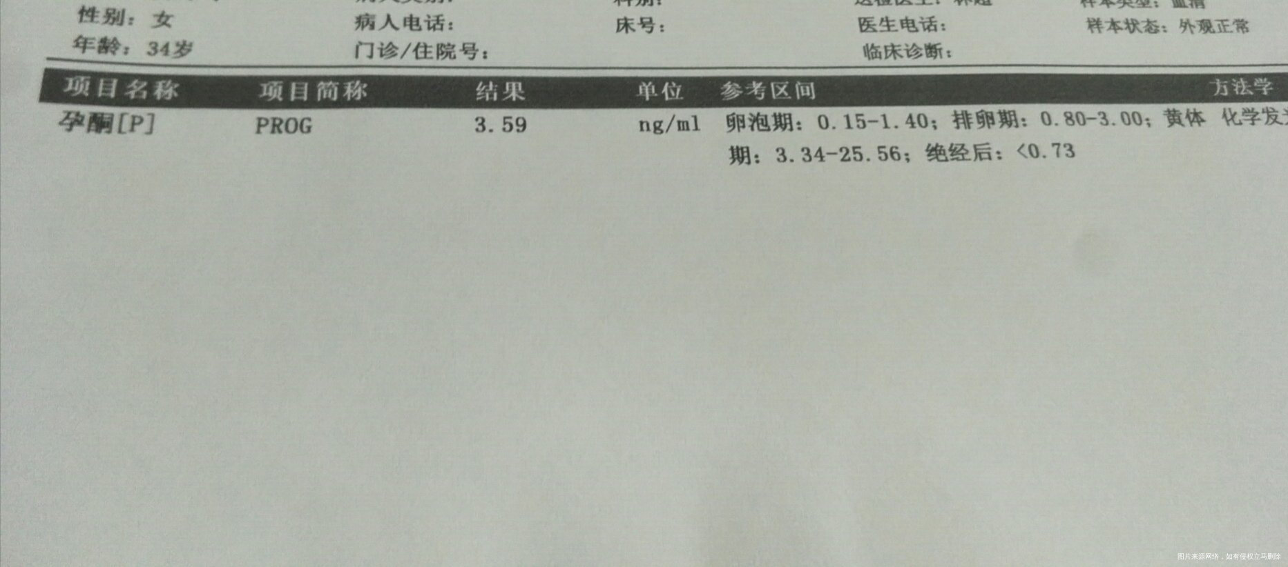 hcg550孕酮下降了35这个是生化妊娠?