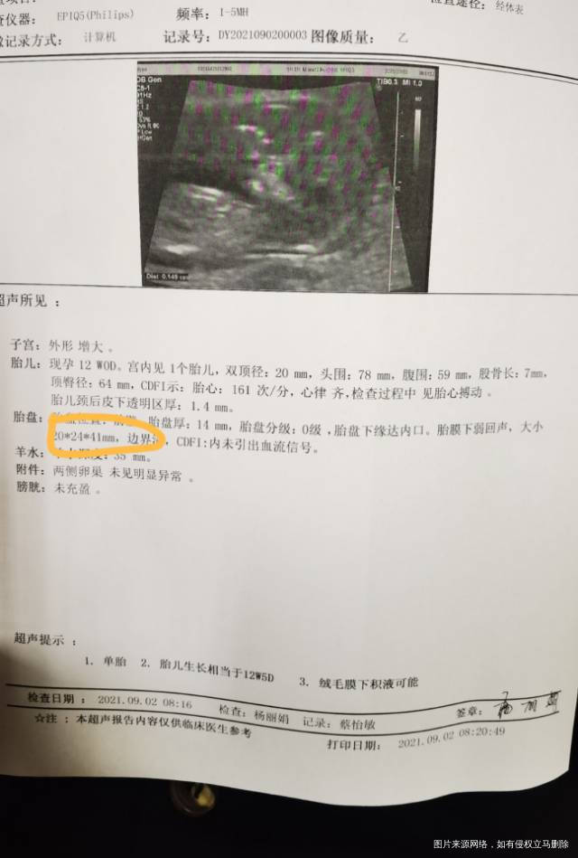 二超时候检查孕囊旁有积液现在是毛胎膜下有积液