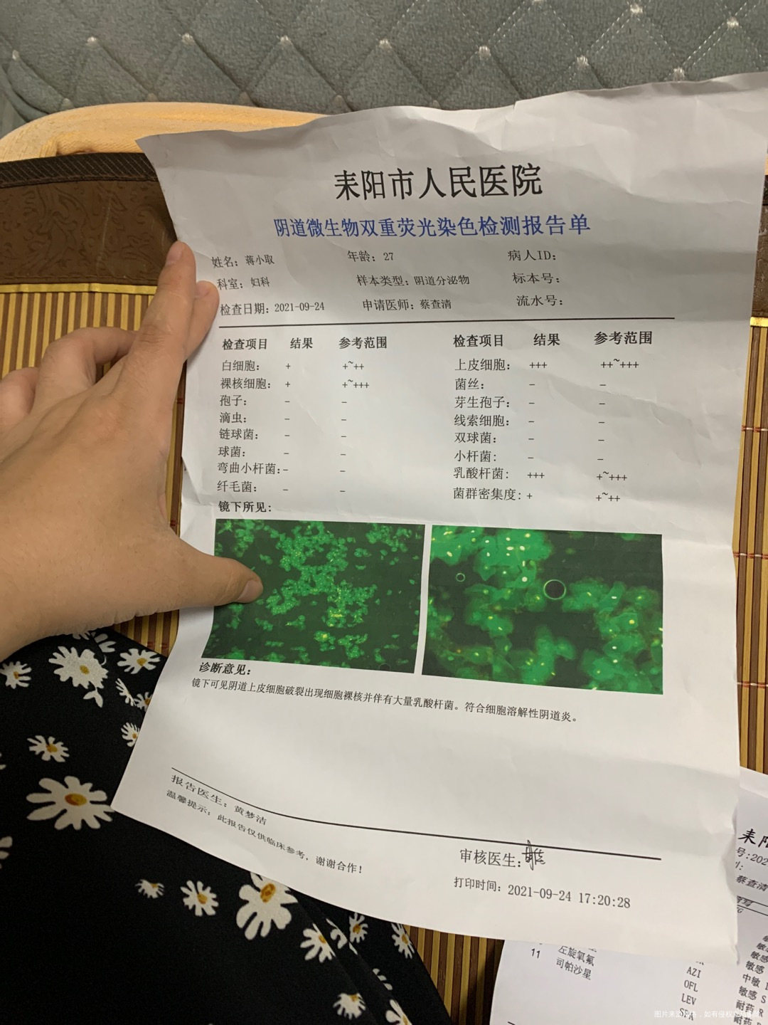 请问这个炎症还有解脲脲原体对怀孕影响大吗