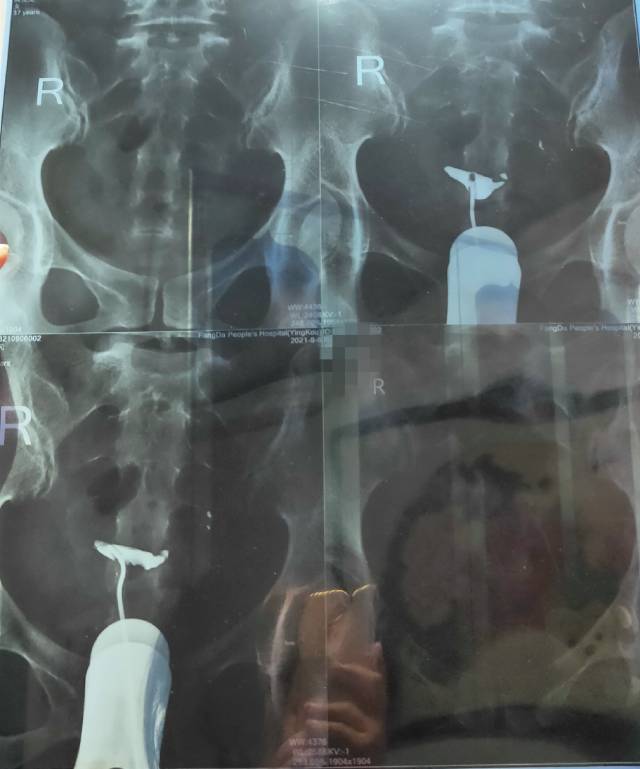 37周岁这种情况好治疗吗怎么治疗方法好呢