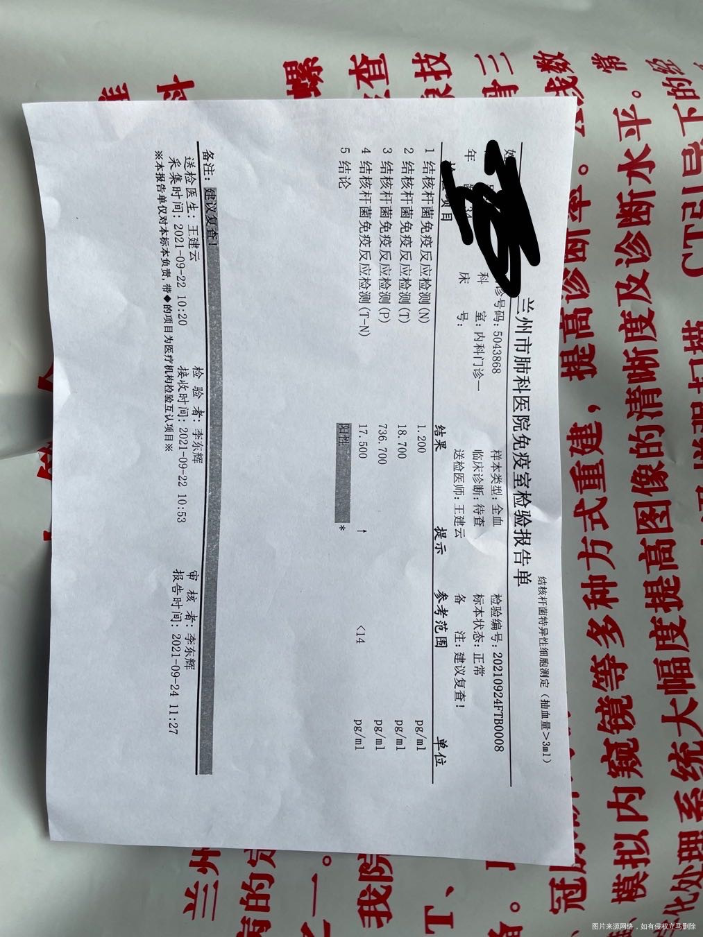 请问医生结核t细胞阳性对试管移植影响大吗