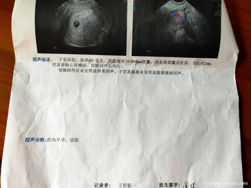 孕41天做的b超医生说小孕囊怕宝宝涨着胎停绒