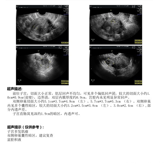 医生我这是不是有子宫腺肌症需要怎样治疗能帮忙
