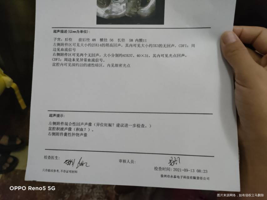 宫外孕第一次B超显示左附件有个2121的增强