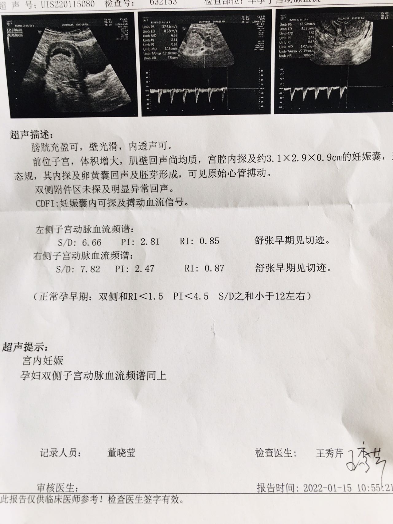 试管婴儿今天孕58天子宫动脉太高上周查的还可