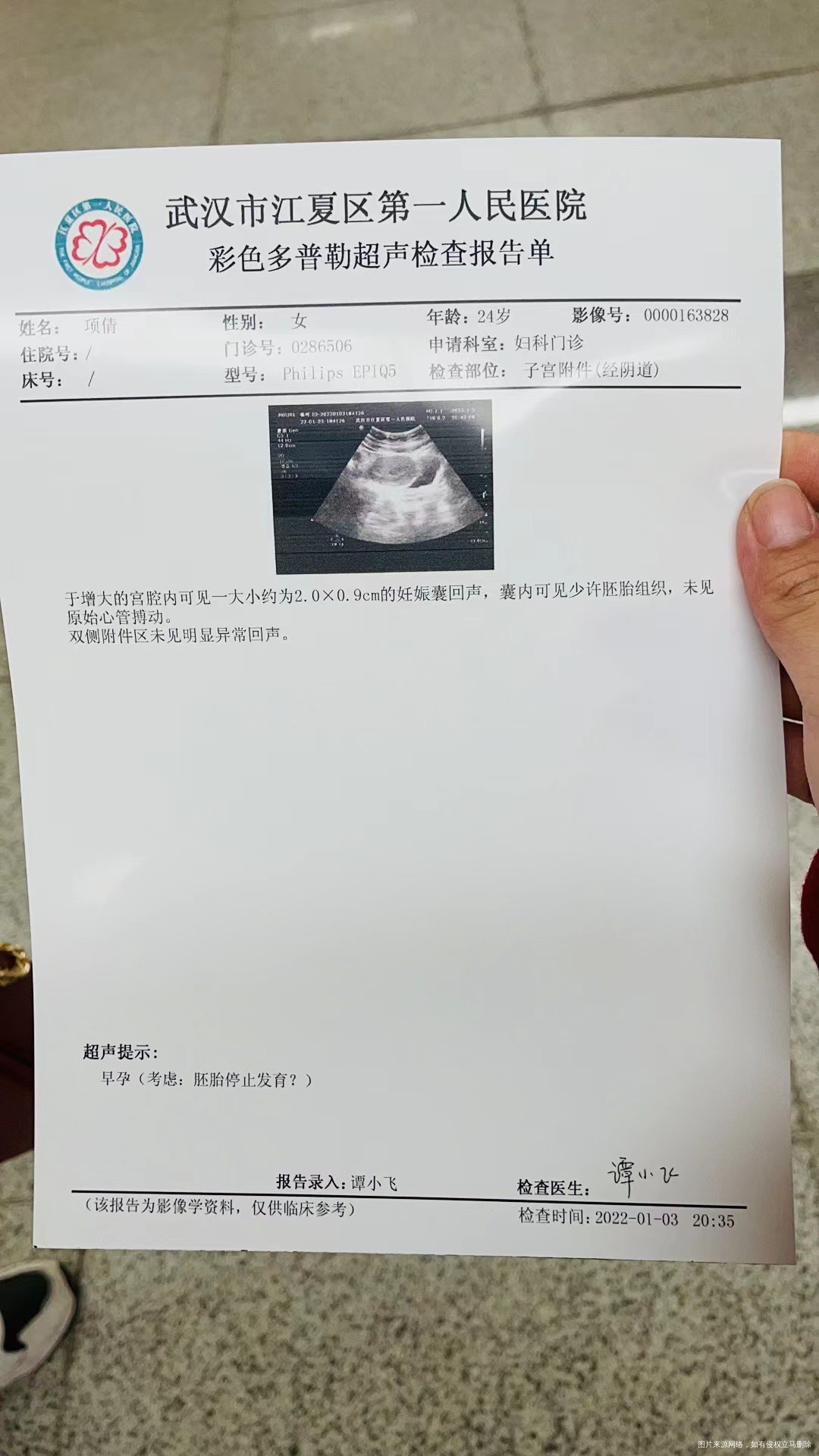 我是114号来的月经但是经期一直不准12月份