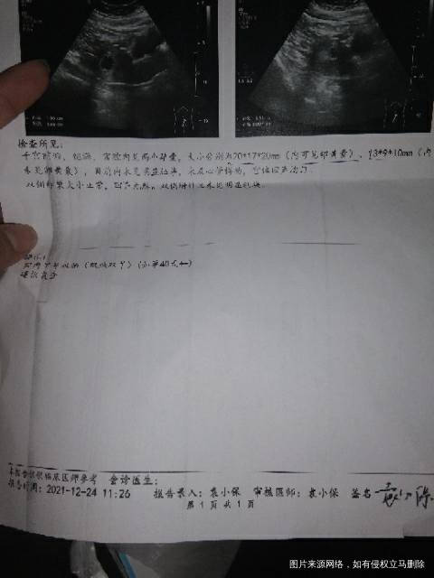 小的那个长是长了一点还没出胎心胎芽会不会对正