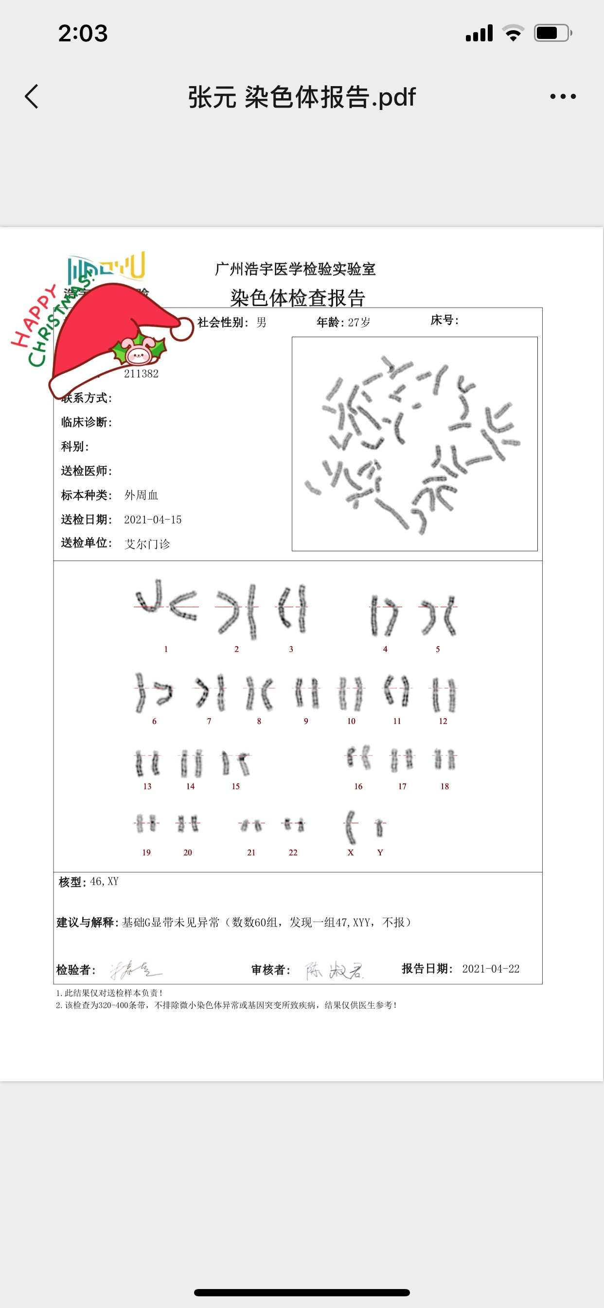 这份染色体报告正常吗