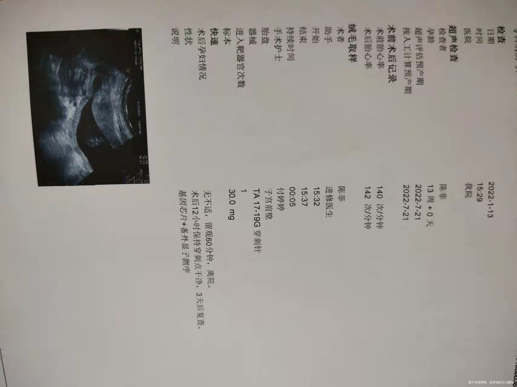 因为NT值高所以今天做了绒毛穿刺手术报告出来