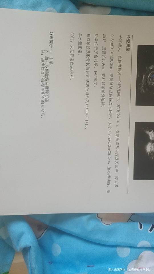 大夫帮我看看彩超囊肿有事吗