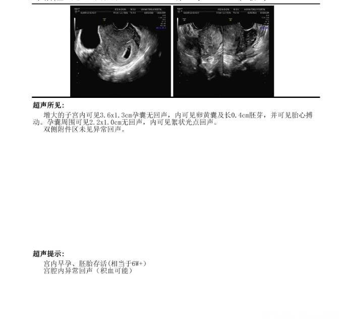 好怕保不住没有腹痛有时候也看不到有血但是b超