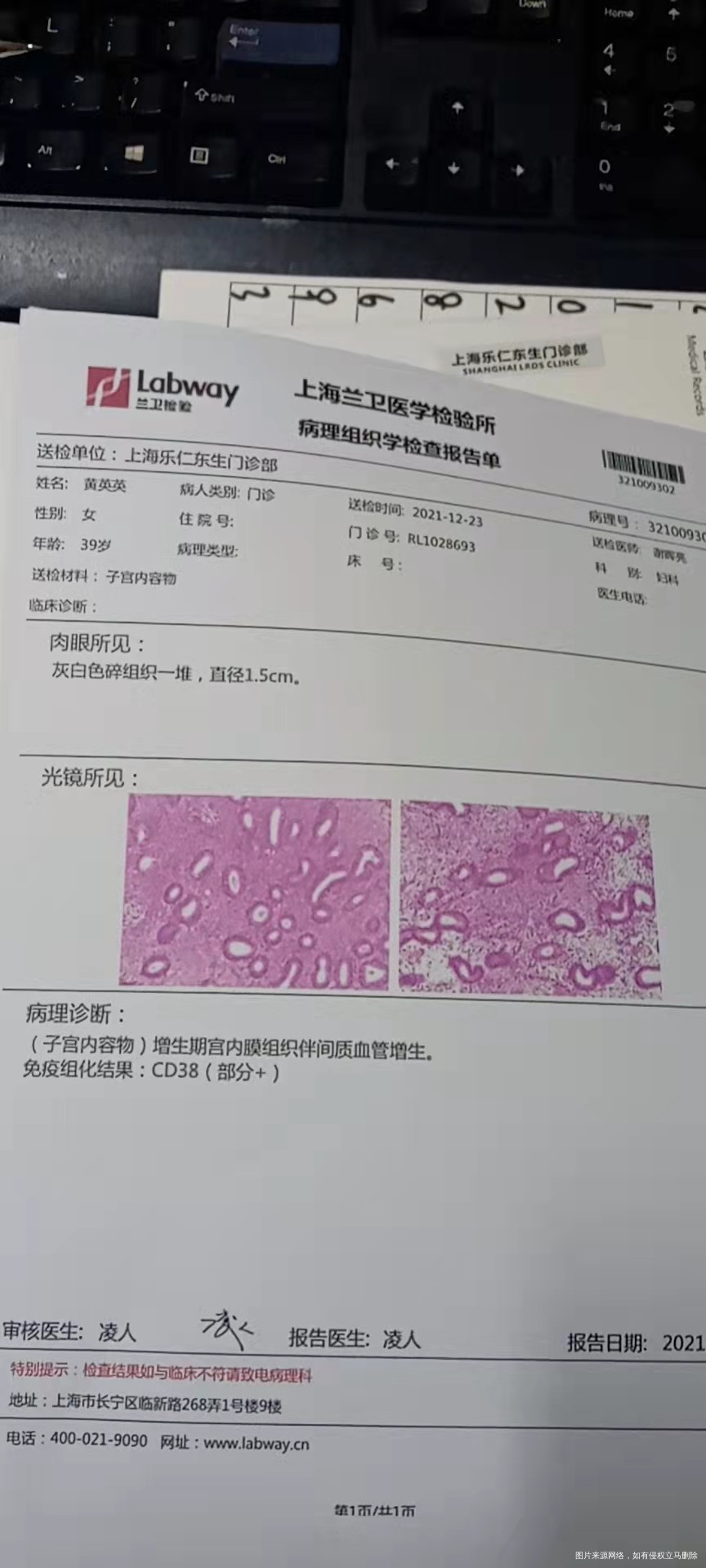 1222做的宫腔镜病例报告有医生帮忙看看吗是