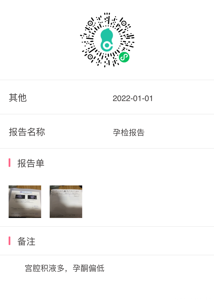孕早期第八周多两天宫腔积液严重孕酮偏低胎芽胎