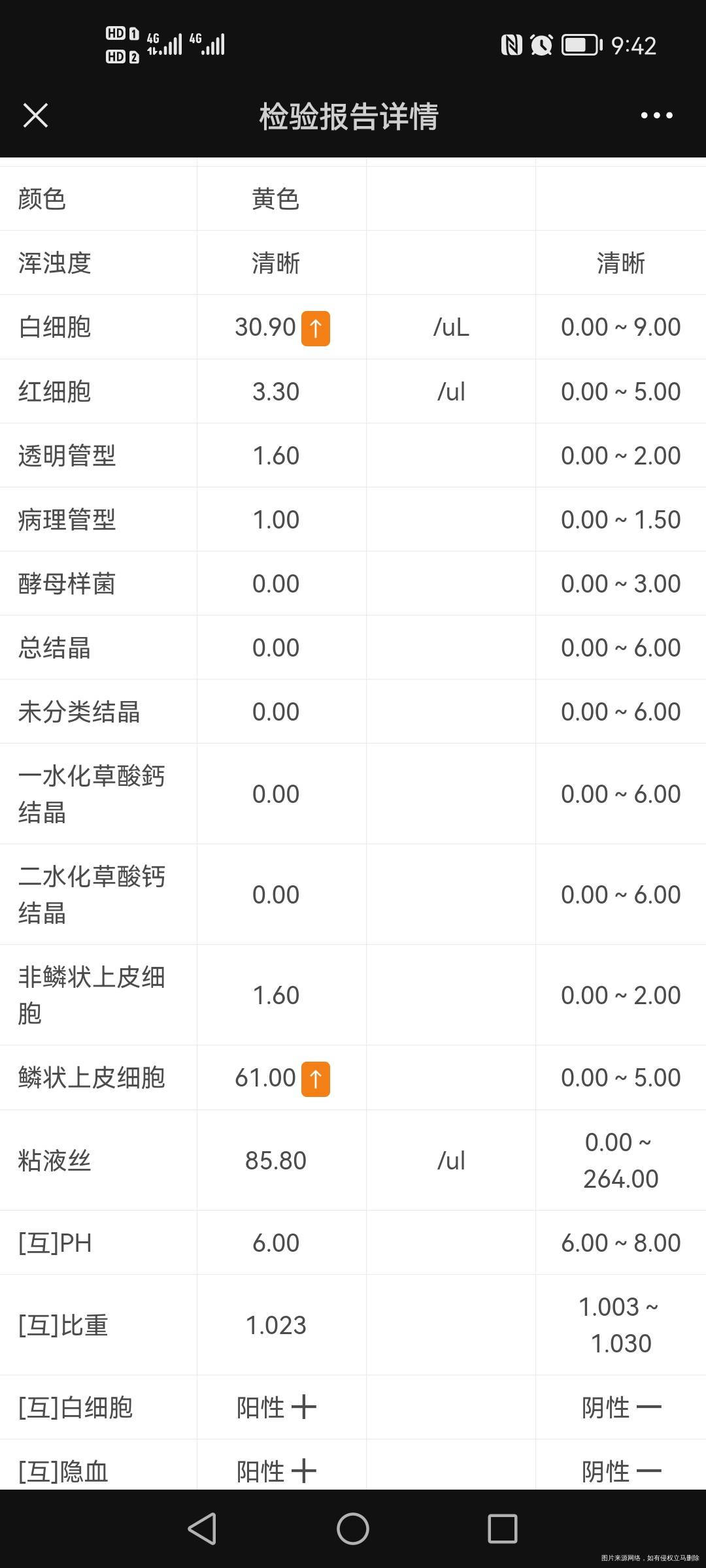 你好麻烦看一下尿检结果高是什么情况呢
